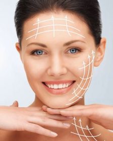 Căng da mặt bằng chỉ là gì? Nên nâng cơ mặt hay không?