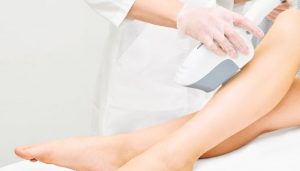 Công nghệ triệt lông IPL