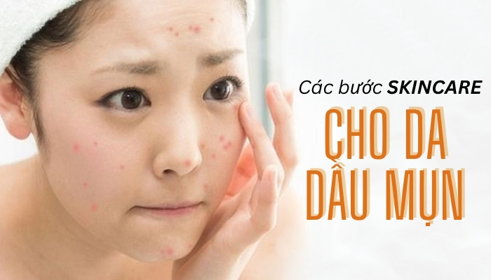 Các bước skincare cho da dầu mụn vào ban đêm chị em nên biết