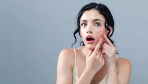 Quy trình chăm sóc da sau nặn mụn