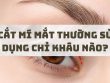 Cắt mí mắt