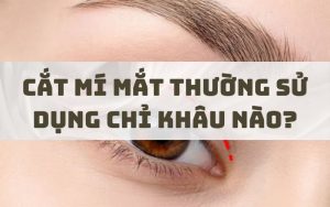 Cắt mí mắt