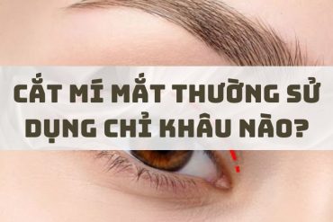 Nâng Mũi Bằng Chỉ Là Gì? Có An Toàn Hay Không?