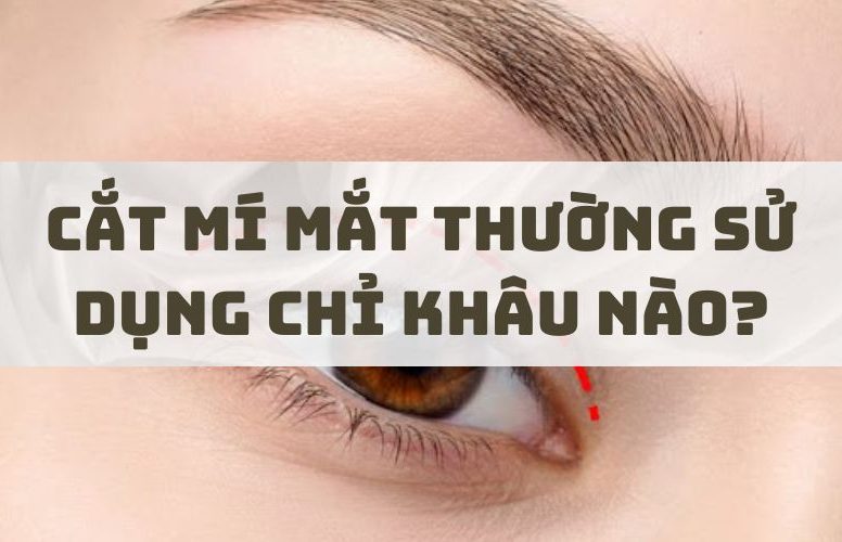 Cắt mí mắt