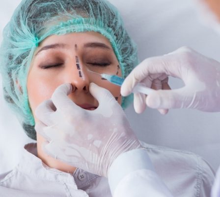 Nâng mũi bằng chỉ là gì? Có an toàn hay không?