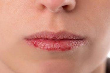cách dưỡng ẩm môi