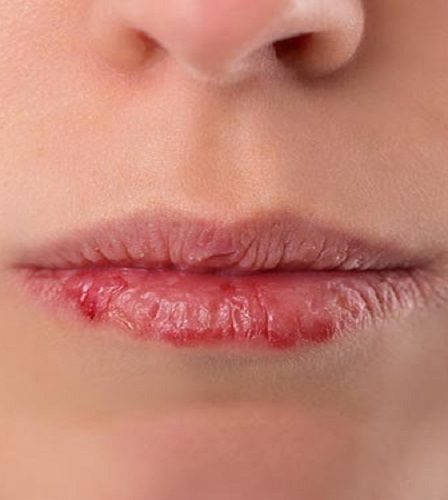 cách dưỡng ẩm môi