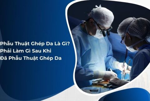 phẫu thuật ghép da