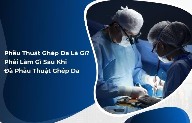 phẫu thuật ghép da